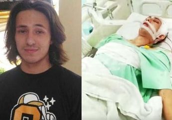 Dokter Sampai Geleng-geleng Kepala Melihat Kondisi Terkini Pesinetron Dylan Carr Usai Alami Kecelakaan Tragis Hingga Koma: Seperti Mukjizat!
