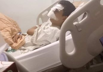 Viral Siswa SMP di Riau Dihajar Temannya Sendiri di Kelas Pakai Kayu, Dibiarkan Guru yang Menjaga Hingga Hidungnya Patah