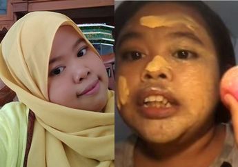 Masih Ingat dengan Tutorial Make Up Balon Ala Rahmawati Kekeyi Putri? Lama Tak Terdengar Kabarnya, Kini Kondisi Keke Justru Bikin Warganet 'Khawatir'
