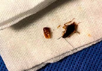 Keluhkan Rasa Sakit Di Bagian Kuping, Dokter Spesialis Pun Terbelalak Saat Dapati Banyak Makhluk Kecil di Dalam Telinga Laki-laki Ini. Apa Penyebabnya?