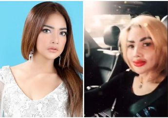Curhat Manja ke Irfan Sebastian Usai Sulam Bibir, Irma Darmawangsa Geram Hingga Parodikan Bibir Dower Barbie Kumalasari: Kayak Banci!
