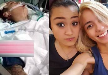 Pasca Kecelakaan Maut 2 Tahun Lalu, Begini Kabar Terbaru Melodya Vanesha! Intip Caranya Mencari Makan Walau Harus Berjalan dengan Tongkat