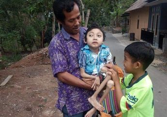 Ibunya Meninggal karena Kanker Serviks, Dimas, Bocah 12 Tahun yang Berbobot 10 Kilogram, Tak Mampu Beraktivitas Hanya Bergantung pada Ayahnya yang Tak Berpenghasilan