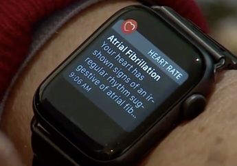 Apple Watch 6 Dapat Beri Peringatan Jika Pengguna Alami Serangan Panik
