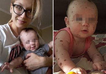 Bayinya Dikatakan Monster Jelek dan Kotor, Seorang Ibu Hampir Membunuh Bayinya