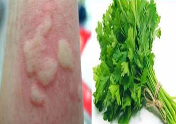 Kesal Biduran Tak Kunjung Hilang? Segera Ambil Seledri Di Dapur Agar Tak Kembali Lagi!