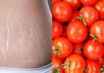 Stretch Mark Bikin Gak Pede? 5 Makanan Ini Dijamin Ampuh Bikin Kulit Mulus Lagi, Wajib Dicoba!