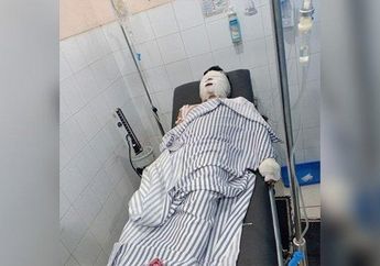 Modus Perampokan Baru! Janjian Bercinta di Hotel, Pria Asal Karawang Ini Justru Dipukuli dan Dibakar Hidup-hidup