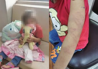 Tak Diinginkan oleh Ayah Barunya, Bocah 2 Tahun Dibuang di Rumah Singgah dengan Luka Bekas Memar di Sekujur Tubuh, Sang Ibu Sempat Beri Pesan: Maafkan Ibu Telah Melakukan Ini