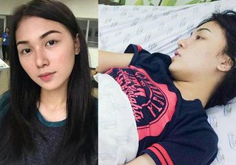 Wanita Ini Shock Saat Bangun Pagi dan Tiba-tiba Tak Bisa Melihat Lagi! Dokter Sebut Penyebabnya Karena Air Putih
