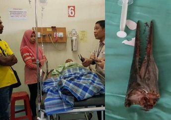 Awalnya Hanya Bantu Ayah Memancing, Pemuda Ini Nyaris Tewas saat Lehernya Tertembus Moncong Ikan Marlin, Begini Cerita Dokter pada Detik-detik Menegangkan Proses Operasi