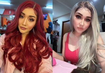 Pamer Hasil Filler Bibir yang Super Seksi, Lucinta Luna: Jadi Seperti Kylie Jenner!