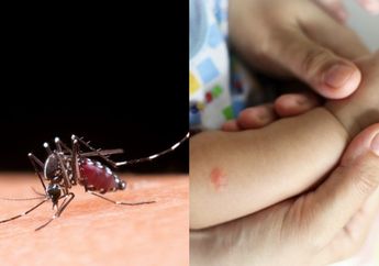 Gejala Baru Penyakit DBD, Ternyata Bukan Lagi Ditandai dengan Bintik Merah!
