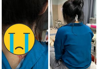 Viral Kisah Perempuan yang Ditepuk Orang Tak Dikanal Tau-tau Jadi Korban Penyiletan Hingga Lehernya Robek, Netizen: Kok Makin Ngeri Aja Sih Kelakuakn Human Bumi Jaman Sekarang!