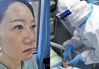 Viral Potret Memprihatinkan Kondisi Petugas Medis Pasien Virus Corona Setelah Berjam-jam Kenakan Seragam Khusus, Wajah dan Tangannya Keriput Penuh Luka