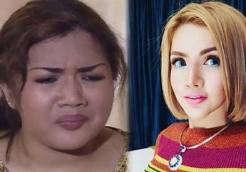 Bak Bumi dan Langit, Transformasi Artis Ini Sukses Tuai Pujian Saat Tampil Natural Usai Lakukan Perawatan Senilai Rp 4 Miliar