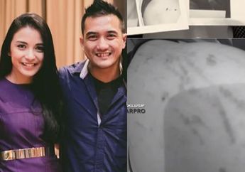 Kakak Kandung Chelsea Olivia Dilaporkan Lakukan KDRT! Istri Dipukuli dengan Gagang Pisau sampai Babak Belur!