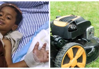 Tangannya Terputus oleh Mesin Pemotong Rumput, Bocah 4 Tahun Ini Harus Jalani Operasi Rumit Demi Selamatkan Masa Depannya, Begini Cara Dokter Melakukannya