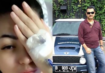 Pernikahan Hanya Seumur Jagung Hingga Diusir Sang Suami, Kini Penampilan Christy Jusung Usai 4 Tahun Menjanda Jadi Sorotan, Warganet: 'Kesepian Ya?'