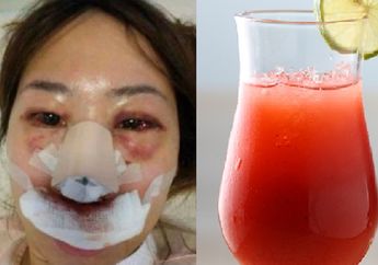 Segelas Jus Apel Jadi Saksi Bisu Penganiayaan Dokter Terhadap Kekasihnya, Bermula dari Ditolak Berhubungan Intim