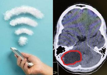 Bukan Cuma Makanan Kemasan, WIFI Bisa Menyebabkan Tumor Otak Pada Anak, Hati-hati