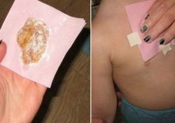 Tak Perlu Minum Obat, Bumbu Dapur ini Bisa Menyembuhkan Batuk Berdahak dengan Seketika