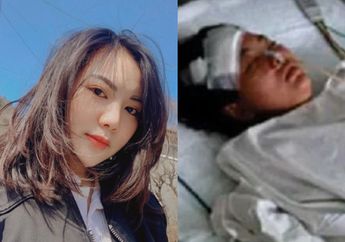 Tak Sadar Punya Teman Psikopat, Begini Nasib YouTuber Cantik yang Dulu Ditusuk Pisau 17 Kali hingga Paru-parunya Bocor