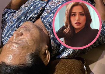 Ditabrak Mobil Saat Naik Motor, Kondisi Ayah Jessica Iskandar Seperti Ini