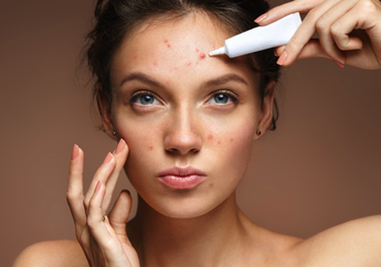 5 Cara Skincare-an yang Salah Kaprah Banget. Jangan Dilakukan, Girls!