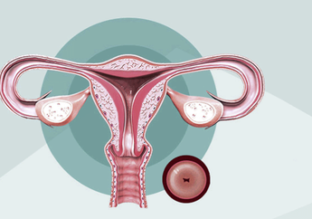 Kanker Serviks Bisa Dicegah dengan Pap Smear? Begini Caranya!