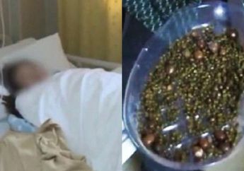 Waspada! Tak Pernah Sarapan dan Kurang Minum Air Putih, Wanita Ini Syok Ketika Dokter Temukan Hal Ini di Dalam Perutnya