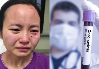 Tega Banget! Tolak Dirawat, Pasien Corona Ini Pukul Hingga Gigit Wajah Perawat! Begini Keadaan Akhirnya