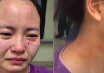 Pertaruhkan Nyawa di Garda Terdepan Lawan Covid-19, Petugas Medis Hanya Bisa Menahan Tangis Usai Alami Kekerasan dari Pasien Positif Corona Hingga Sekujur Tubuhnya Luka!