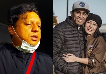 Nanda Persada, Ikatan Manajemen Artis Indonesia Jelaskan Sebab Meninggalnya Glenn Fredly Bukan karena Covid-19