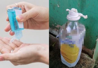 Memilukan, Bocah 3 Tahun di Karawang 'Terlahap' Api saat Pegang Botol Hand Sanitizer, Sekujur Tubuhnya Terbakar Tapi Sempat Ditolak Rumah Sakit, Begini Keadaannya Kini