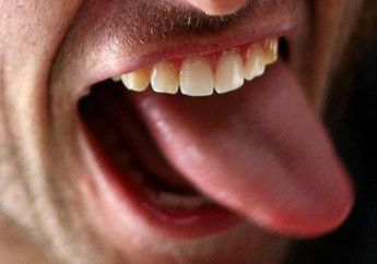 Viral! Pria Ini Ditemukan Tak Sadarkan Diri sambil Memegang Lidahnya yang Sudah Putus