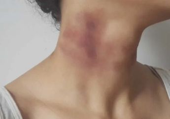 Beberapa Wanita di Malaysia Alami Kekerasan dalam Rumah Tangga setelah MCO di Tengah Wabah Virus Corona
