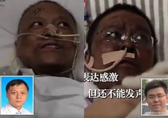 Kulit Tiba-tiba Jadi Gosong, Dua Dokter dari Wuhan Ini Alami Gejala Covid-19 yang Aneh Selama Jalani Perawatan di Rumah Sakit, Terungkap Penyebabnya
