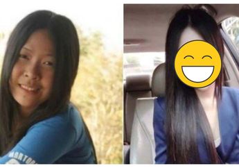 Tak Terima Diputus Sang Pacar Karena Dianggap Tak Cantik, Wanita ini pun Rela Lakukan Opersai Plastik Hingga Wajahnya Berubah Bak Princess, Begini Hasilnya...