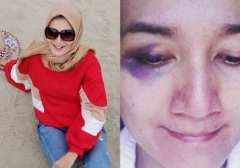 Muncul dengan Wajah Bonyok Diduga Akibat KDRT, Nasib Pedangdut Cantik Ini Berubah Drastis, Kini Tampak Lebih Bahagia Hingga Kerap Plesiran Mewah Bersama Keluarga