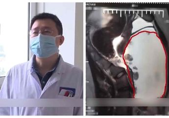 Perut Anaknya Membesar Seperti Hamil, Orang Tua Panik Karena Usia Anaknya Baru 15, Setelah diperiksa Dokter Orang tuanya Justru Makin Panik Mengetahui Hal Ini