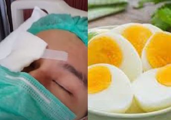 Sempat Diidap Baim Wong Sampai Harus Segera Operasi Mata, Siapa Sangka Ternyata 4 Menu Favorit Ini Bisa Jadi Makanan Pencegah Katarak