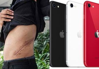 Remaja ini 9 Tahun Lalu Rela Jual Ginjalnya Seharga Rp 245 Juta Demi Iphone, Kini Ia Pun Menyesal Karena Jadi Tak Bisa Berjalan, Miskin, dan Sakit-sakitan, Bahkan Sampai Harus Rutin Cuci Darah!