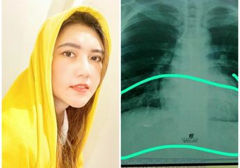 Padahal Awalnya Non Reaktif, Kini Via Vallen Ungkap sang Adik Dinyatakan Positif Corona: Jumlah Orang Terpapar Lebih Besar dari Jumlah di Data!