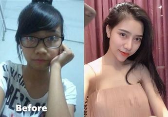 Wanita ini Dibenci Ibunya Sendiri Usai Permak Penampilannya dengan Operasi Plastik Hingga Berubah Cantik, Perbandingan Sebelum dan Sesudahnya Bikin Melongo