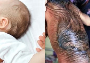 Bayi ini Dilahirkan dalam Kondisi Tak Wajar Hingga Membuat Ruangan Operasi Gempar, Orangtuanya Justru Berikan Reaksi Tak Terduga, Ada Apa?