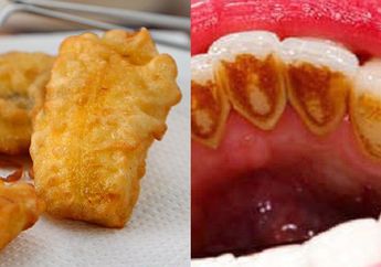 BERITA TERPOPULER: Dari Cara Bikin Pisang Goreng Tetap Renyah walau Dingin sampai Bahan Alami ini Bikin Karang Gigi Rontok