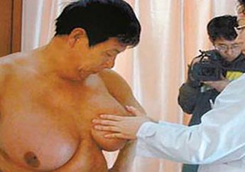 Aneh Tapi Nyata, Payudara Pria Ini Mendadak Besar Karena Kebanyakan Makan Fried Chicken! Ini Penjelasan Dokter
