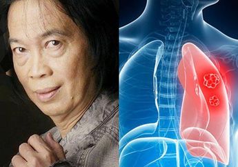 Aktor Senior Ini Meninggal Karena Kanker Paru-Paru, Makanan Favorit Anak Muda ini Bisa Jadi Penyebab Utamanya, Waspada!