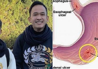 Waspada! Kebiasaan Makan Seperti ini Bisa Memicu Penyakit Serius, Bertrand Peto Anak Ruben Onsu Sampe Dibikin Pucat!